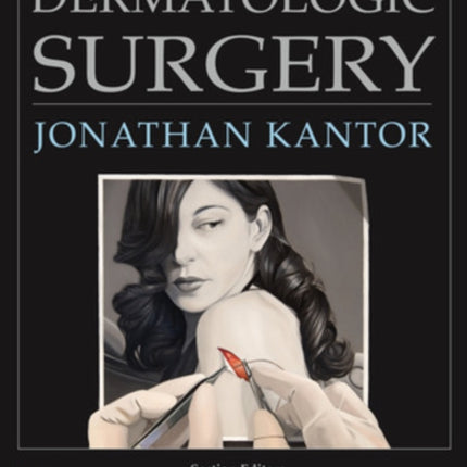 Dermatologic Surgery