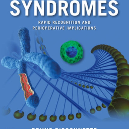 Syndromes: Rapid Recognition and Perioperative Implications