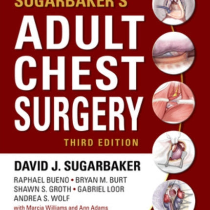 Sugarbaker's Adult Chest Surgery