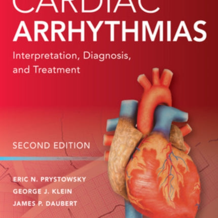 Cardiac Arrhythmias: Interpretation, Diagnosis and Treatment, Second Edition