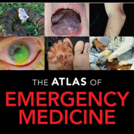 Atlas of Emergency Medicine