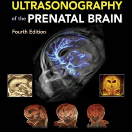 Timor's Ultrasonography of the Prenatal Brain, Fourth Edition