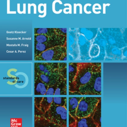 Lung Cancer:  Standards of Care