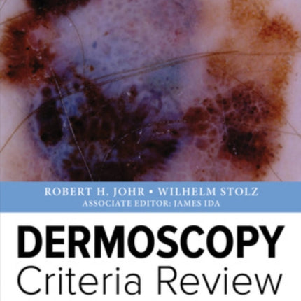 Dermoscopy  Criteria Review