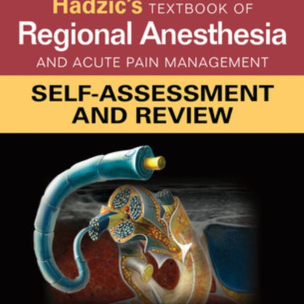 Hadzic's Textbook of Regional Anesthesia and Acute Pain Management: Self-Assessment and Review