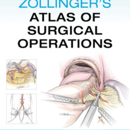 Zollinger's Atlas of Surgical Operations, Eleventh Edition