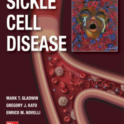 Sickle Cell Disease