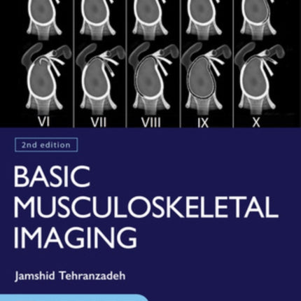Basic Musculoskeletal Imaging Second Edition