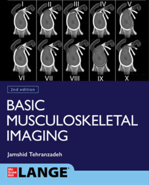 Basic Musculoskeletal Imaging Second Edition