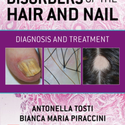 Disorders of the Hair and Nail Diagnosis and