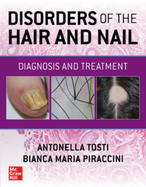 Disorders of the Hair and Nail Diagnosis and