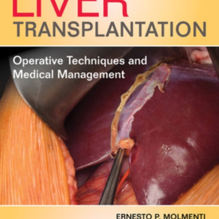 Liver Transplantation: Operative Techniques and Medical Management