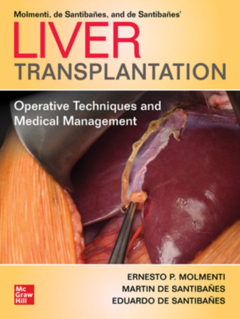 Liver Transplantation: Operative Techniques and Medical Management