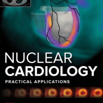 Nuclear Cardiology: Practical Applications, Fourth Edition