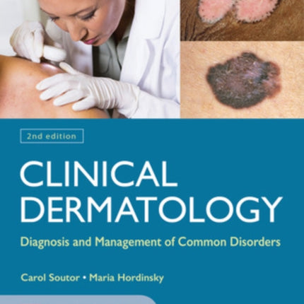 Clinical Dermatology: Diagnosis and Management of Common Disorders, Second Edition