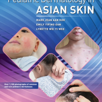 Atlas of Pediatric Dermatology in Asian Skin