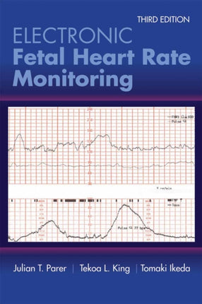 Electronic Fetal Heart Rate Monitoring The 5Ti