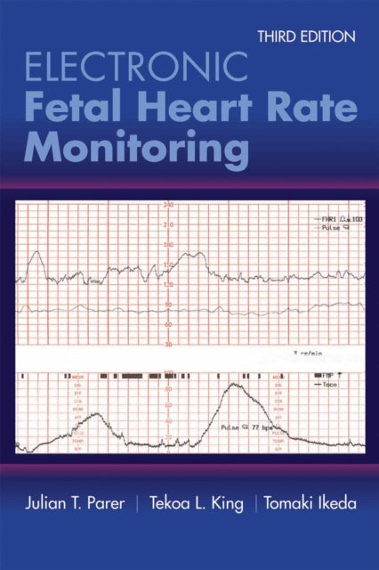Electronic Fetal Heart Rate Monitoring The 5Ti