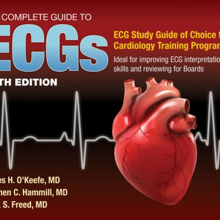 The Complete Guide to ECGs A Comprehensive Stud