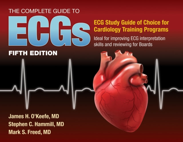 The Complete Guide to ECGs A Comprehensive Stud