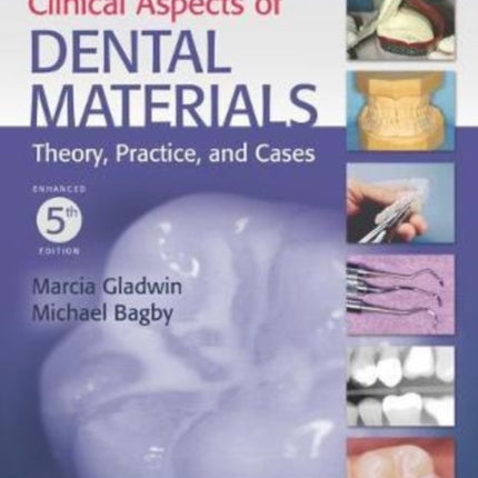 Clinical Aspects Of Dental Materials