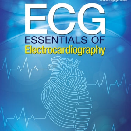 ECG