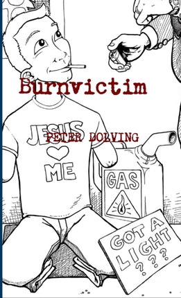 Burnvictim