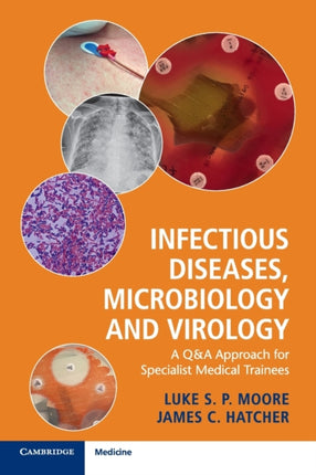 Infectious Diseases Microbiology and Virology