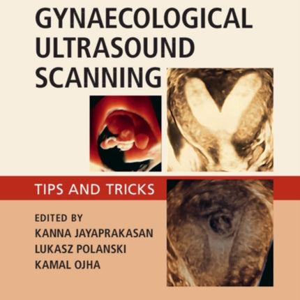 Gynaecological Ultrasound Scanning