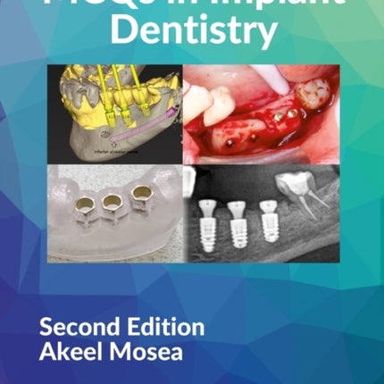 MCQs in Implant Dentistry
