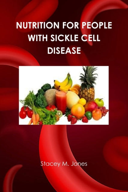 Nutrition for people with Sickle Cell Disease