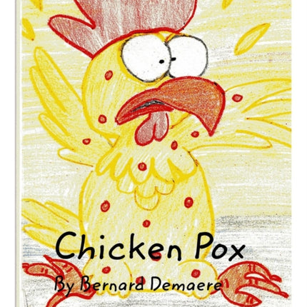 Chicken Pox