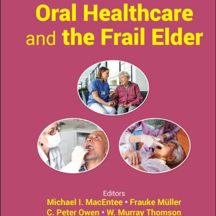 Oral Healthcare and the Frail Elder