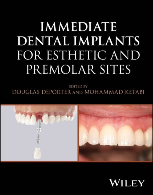 Immediate Dental Implantation Techniques for