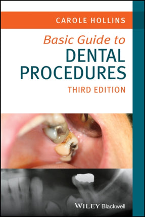 Basic Guide to Dental Procedures 3rd Edition