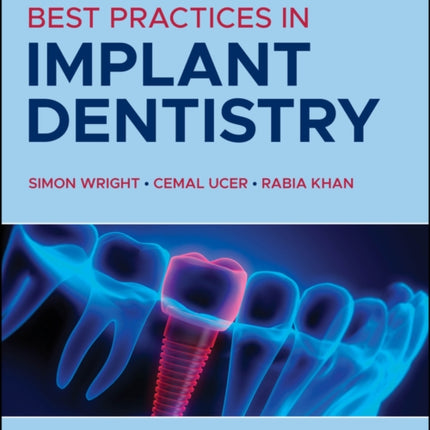 Best Practices in Implant Dentistry