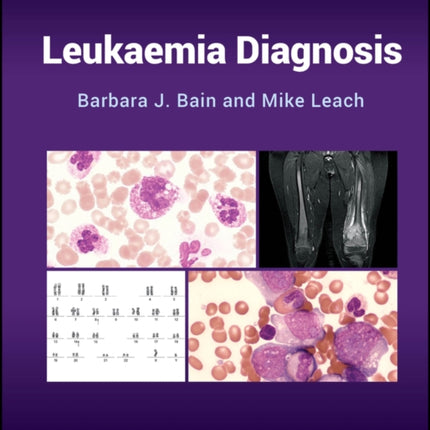 Leukaemia Diagnosis