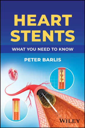 Understanding Heart Stents A Guide for Patients a nd Families