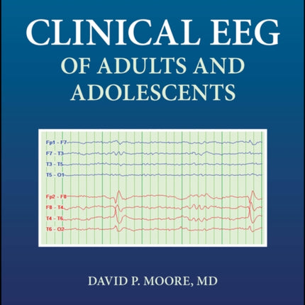 Clinical EEG of Adults and Adolescents