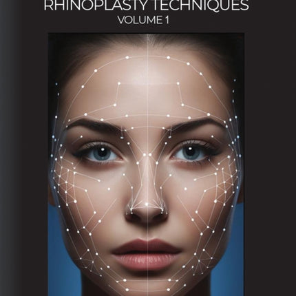 Modern Endonasal Rhinoplasty Techniques  Volume 1