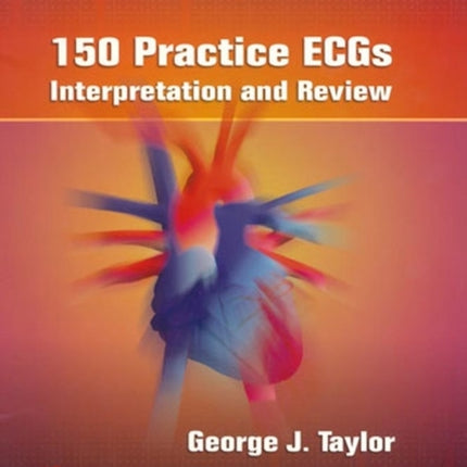 150 Practice ECGs: Interpretation and Review