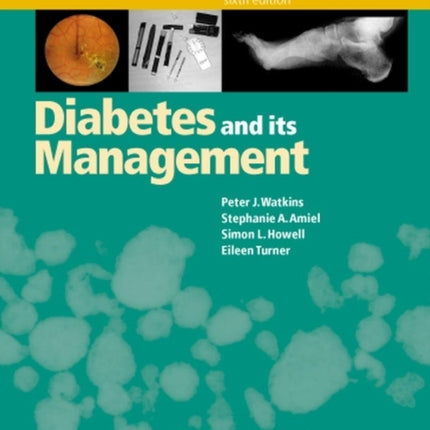 Diabetes and Its Management