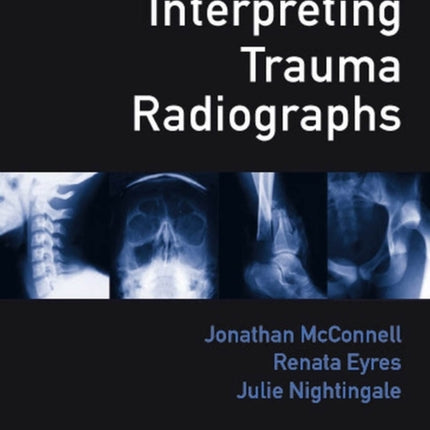 Interpreting Trauma Radiographs