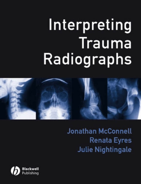 Interpreting Trauma Radiographs