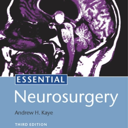 Essential Neurosurgery