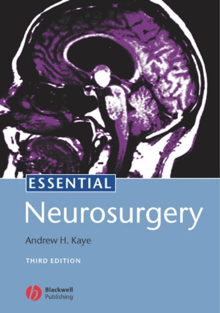 Essential Neurosurgery