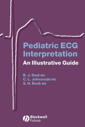 Pediatric ECG Interpretation: An Illustrative Guide