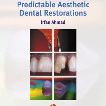 Protocols for Predictable Aesthetic Dental Restorations