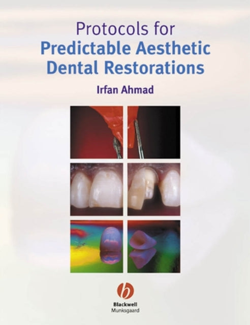 Protocols for Predictable Aesthetic Dental Restorations