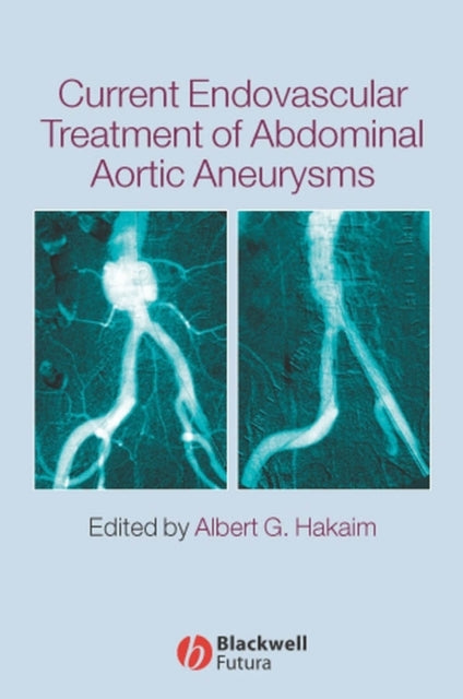 Current Endovascular Treatment of Abdominal